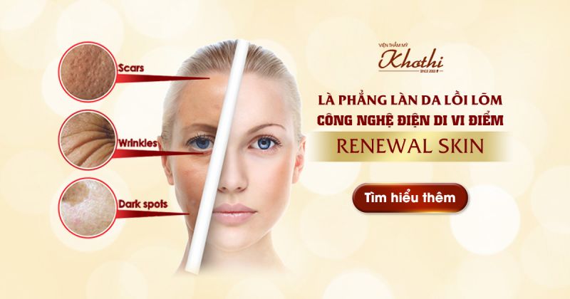 Điều trị sẹo rỗ