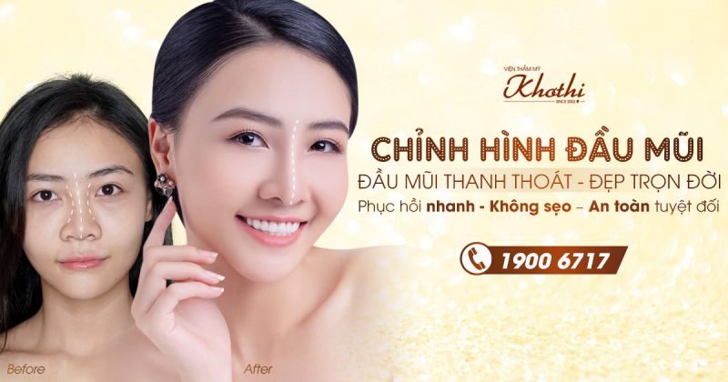 Chỉnh hình đầu mũi